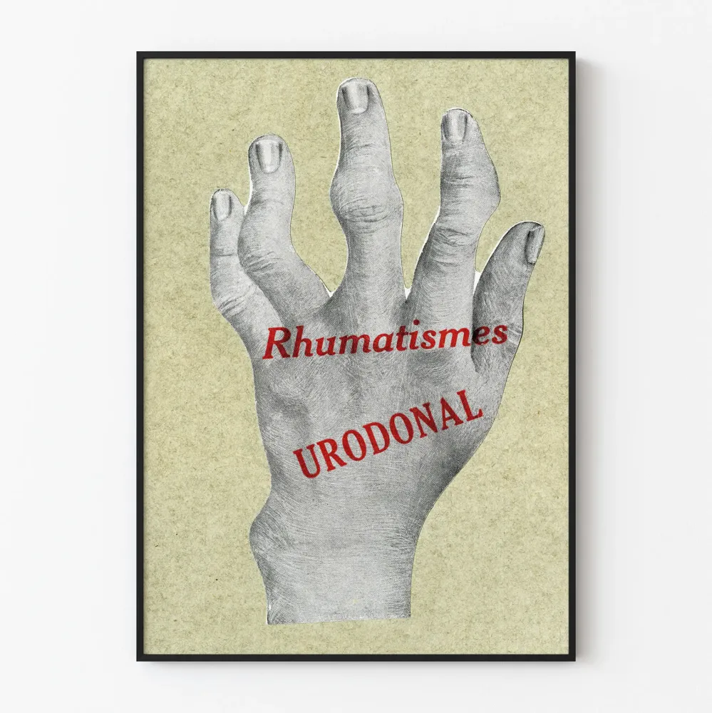 Wintage plakat z deformowaną ręką na reumatyzm - Urodonal