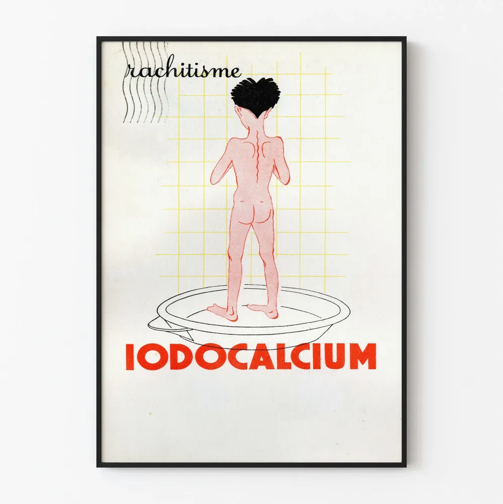 Wintage plakat medyczny o krzywicy i Iodokalcium