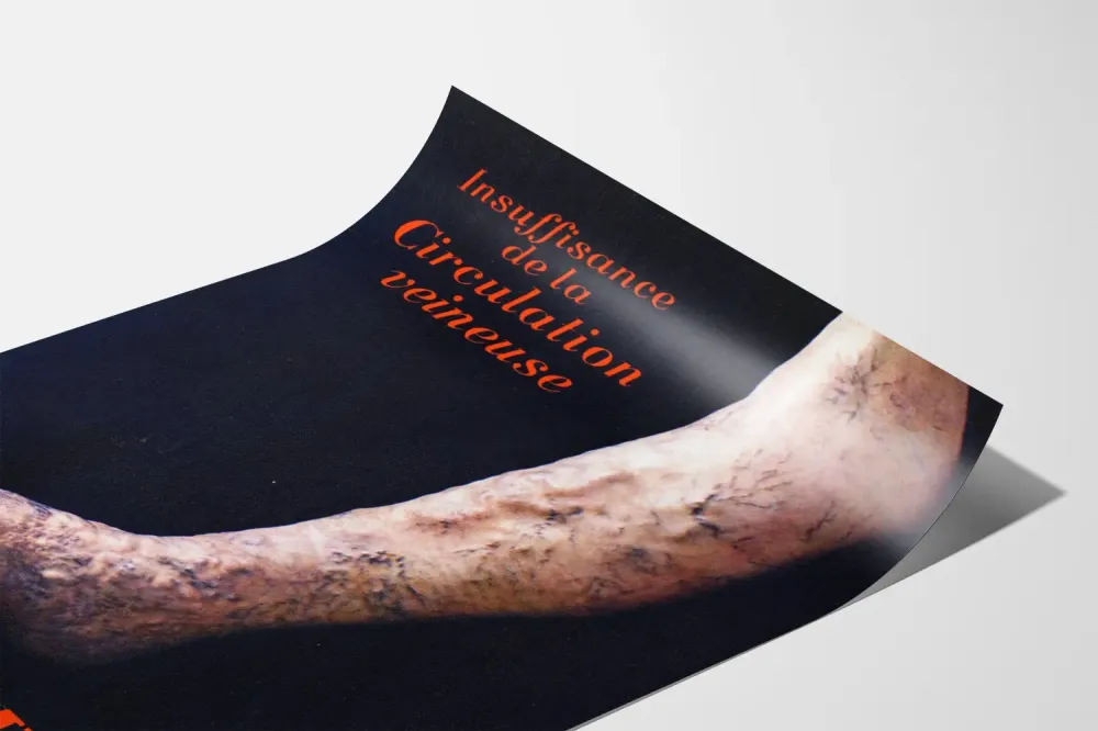 Wintage plakat medyczny - Niewydolność krążenia żylnego
