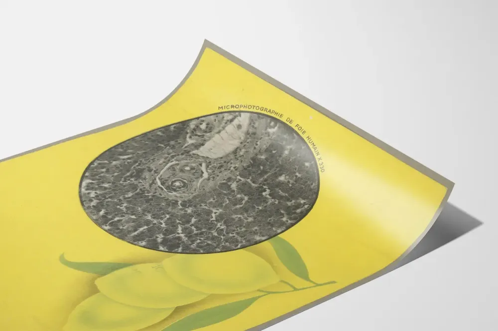Wintage plakat medyczny o niewydolności wątroby